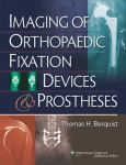 Imaging of Orthopedic Fixation Devices and Prostheses