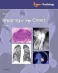 Imaging of the Chest. 2 Volume Set